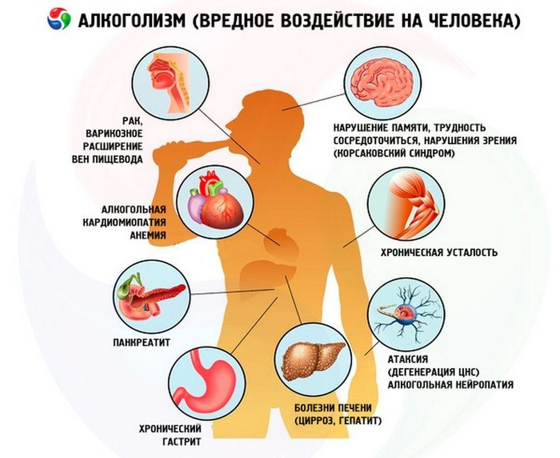 К чему приводит алкоголь картинки